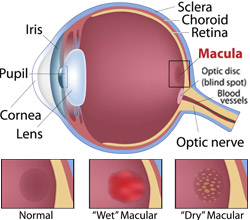 Macular Popup